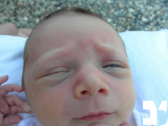 Yuki - 20090824 10.40 - 15 giorni - 996-FDM.JPG